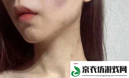 红雅典娜LIYA死了吗