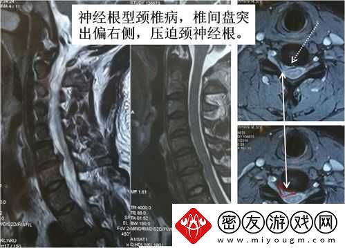 颈腰挺过那层薄膜：开启健康之路